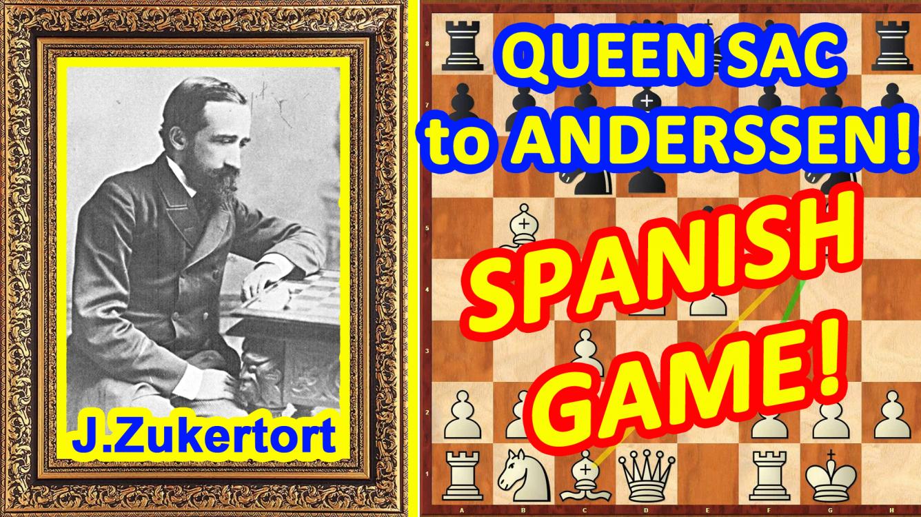 Chess TRAPS in the Spanish Game opening! ♔ Zukertort vs ...
